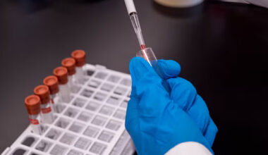 Long-life startup NiaHealth exits stealth with $2.5 million in pre-seed funding