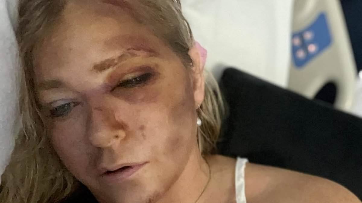 Car accident that has left Jeffrey Epstein victim Virginia Giuffre with 'only four days left to live' was just a 'minor crash', say Australian police