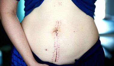 ‘Keep your hands off women’s bodies’