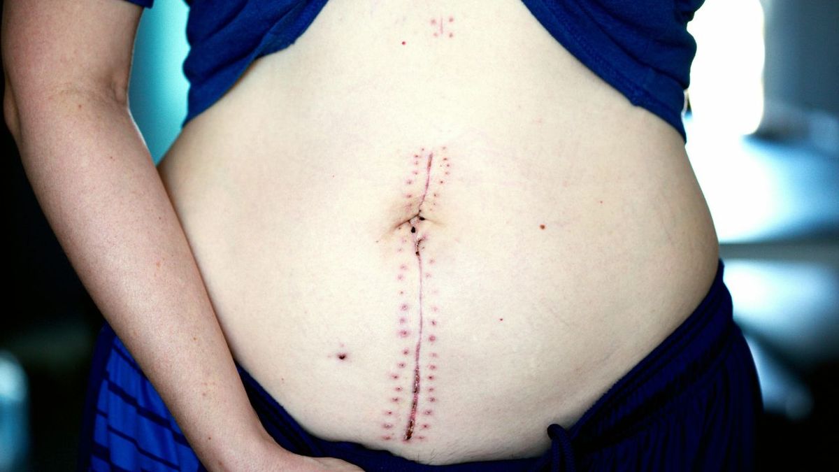 ‘Keep your hands off women’s bodies’