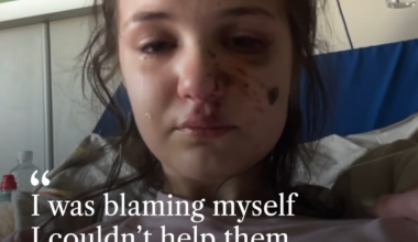 "I was blaming myself. I couldn't help them," said 14-year-old Yana, who was injured in a Russian attack on Kyiv