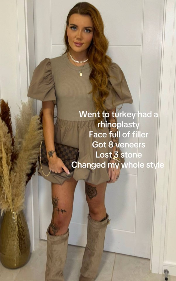 Woman after cosmetic procedures in Turkey.