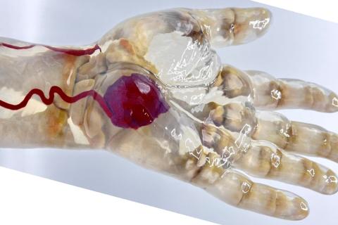 Louis Stokes Cleveland VA Medical Center Models Better Health Care With 3D Printing | VA Northeast Ohio Health Care