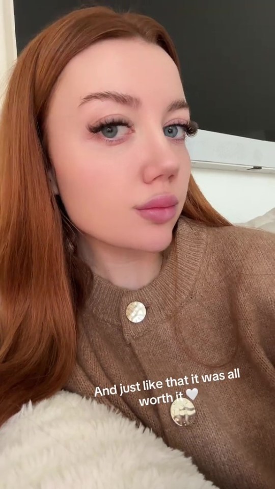 Woman with red hair after cosmetic procedures.