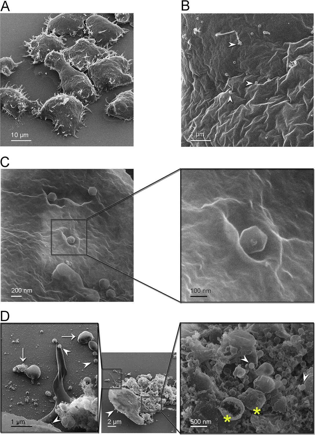 Helium ion microscopy images of Jyvaskylavirus attachment to A. castellanii cells. 
