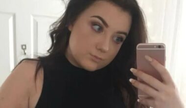 I spent £13k on a Turkey makeover with veneers, a face of filler & a nose job - trolls still say I looked better before