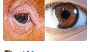 Whose eye? 👀