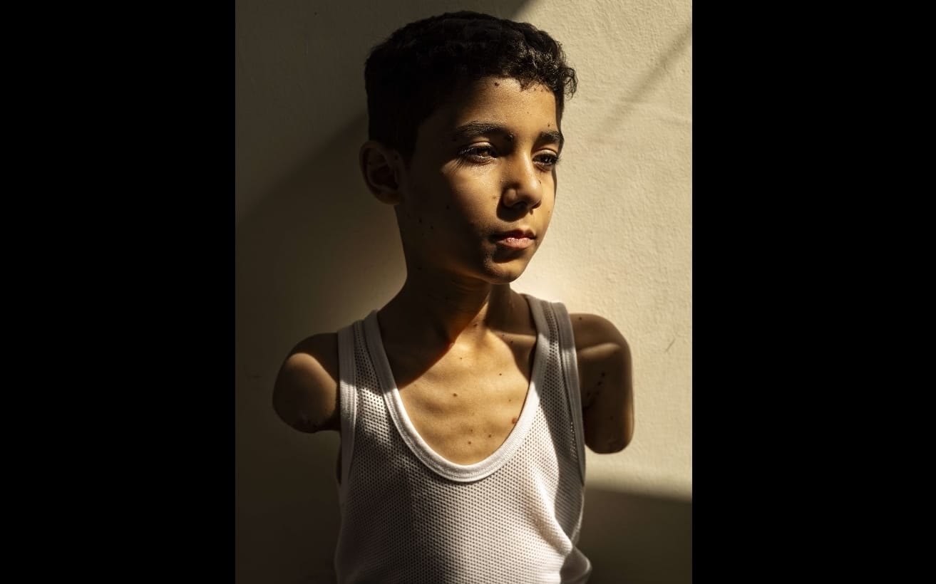 World Press Photo 2025