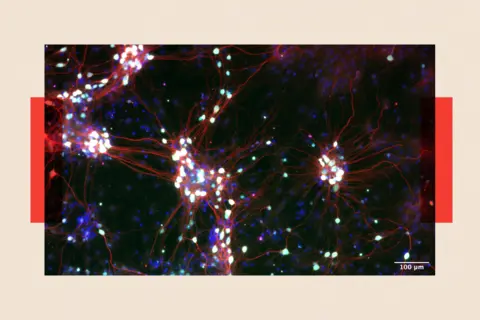 Close-up of nerve cells 