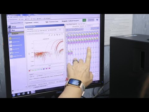La bioinformática, el paso de la computadora al laboratorio para curar enfermedades • FRANCE 24