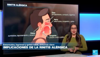 Claves para detectar y tratar la rinitis alérgica • FRANCE 24 Español