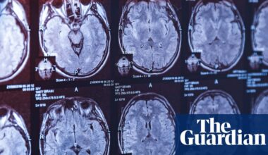 The latest twist in a Canadian medical mystery – podcast | Science