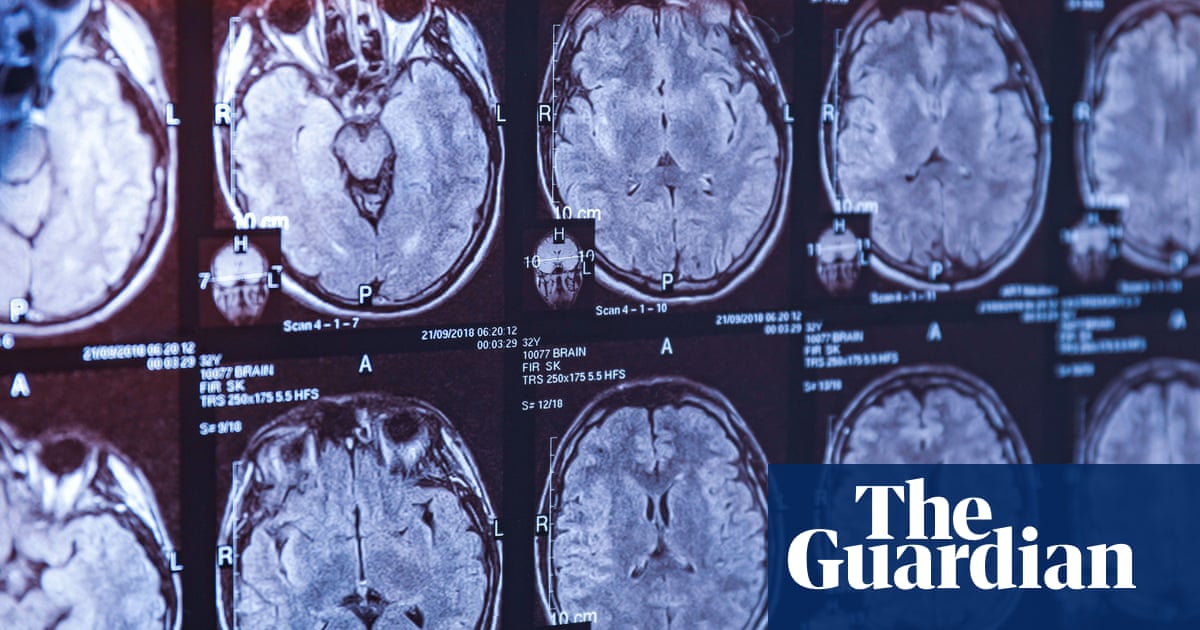 The latest twist in a Canadian medical mystery – podcast | Science