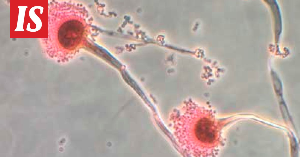 Tutkijat varoittavat vaarallisista sienitaudeista - Ilta-Sanomat