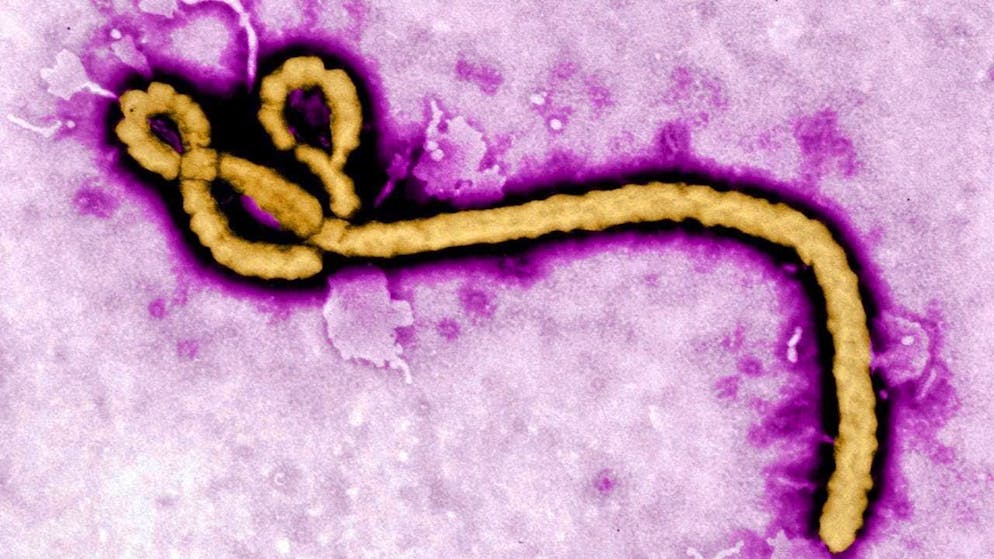 ARCHIVE - Date and location unknown: An electron microscope image shows a single viral particle of the Ebola virus. Photo: Frederick Murphy/CDC/AP/dpa