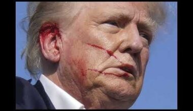 Trump used 10 deceptions to claim he was shot. He had expensive help hiding, that he was injured by his security. Celebrating, with minor collision cuts, as supporters were dying, is a bad look.