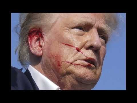 Trump used 10 deceptions to claim he was shot. He had expensive help hiding, that he was injured by his security. Celebrating, with minor collision cuts, as supporters were dying, is a bad look.