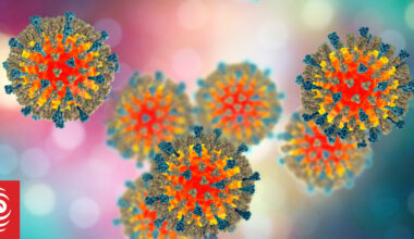 New measles case in Auckland - alerts issued over ferries and supermarket