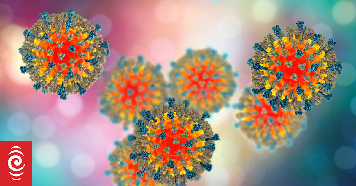 New measles case in Auckland - alerts issued over ferries and supermarket
