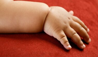 Childhood obesity linked to lower employment and education rates in early adulthood