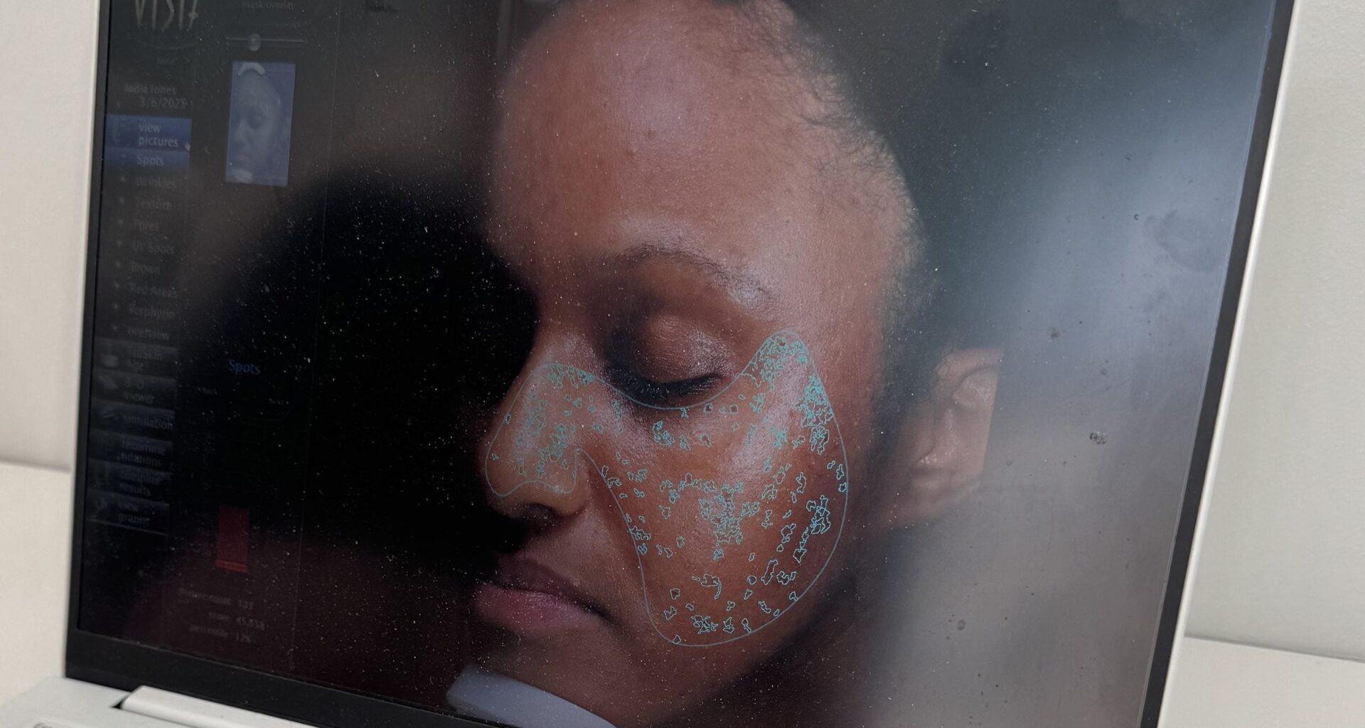 Here's What Happened To My Skin After Going To An Icelandic Spa - Essence