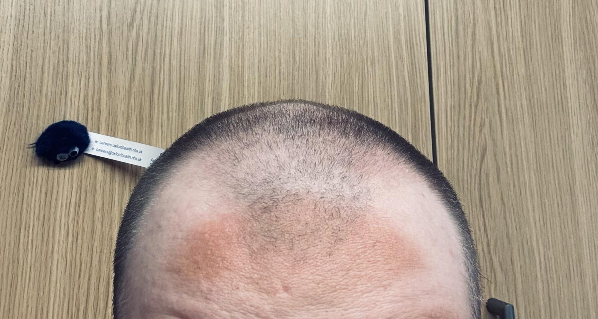 I was not prepared for the sun.