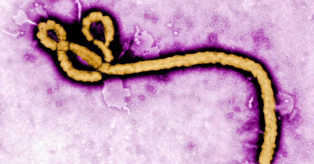 Democratic: Suspected Ebola case in the Czech Republic