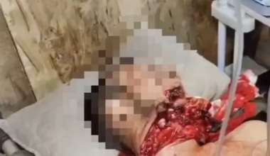 Russian with a missing jaw (VERY NSFW)