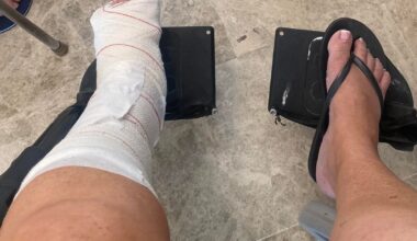 Brit 'left in wheelchair after attack by knuckle duster-armed Benidorm bouncers'