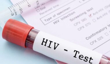 People living with HIV in Moldova are being diagnosed late even though testing is affordable