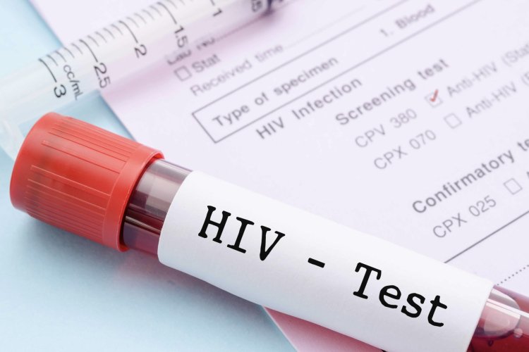 People living with HIV in Moldova are being diagnosed late even though testing is affordable
