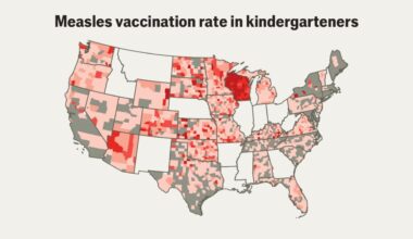 How much worse could America’s measles outbreak get? - The Economist