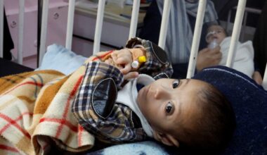 Palestinian children suffering from malnutrition overwhelm Gaza’s Nasser Hospital
