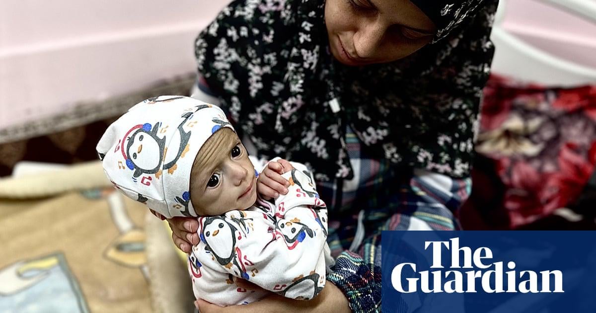 A picture that shocked the world: the story behind baby Siwar Ashour