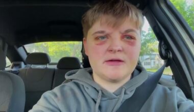 Woman says she was brutally attacked in Carpentersville, Illinois because she's a lesbian