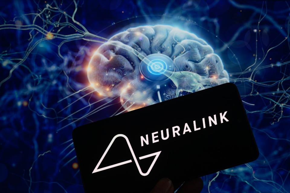 The Neuralink logo is being displayed on a smartphone with a brain chip visible in the background in this photo illustration in Brussels, Belgium.<p>NurPhoto&sol;Getty Images</p>