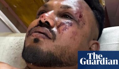 ‘I saw people dying in front of my eyes’: British survivor describes Air India crash | Air India Ahmedabad plane crash