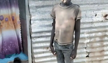 Evan Anzoo, age 5, who died of HIV in South Sudan. (Nicholas Kristof photo courtesy of The New York TImes.)