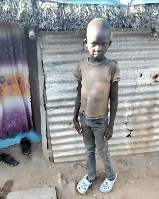 Evan Anzoo, age 5, who died of HIV in South Sudan. (Nicholas Kristof photo courtesy of The New York TImes.)