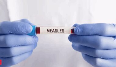 Canada measles crisis: Alberta in panic over worst outbreak in 45 years, memories of pre-vaccine times back