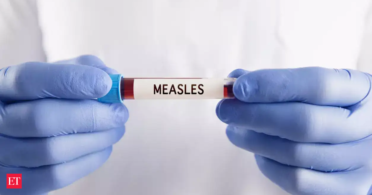 Canada measles crisis: Alberta in panic over worst outbreak in 45 years, memories of pre-vaccine times back
