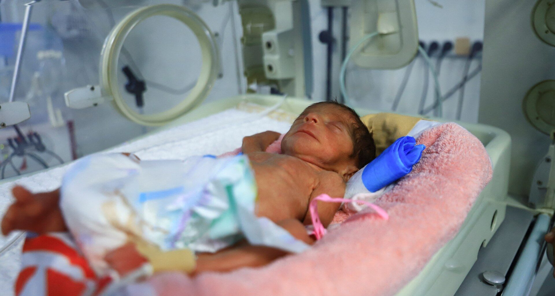 UN reports uptick in preventable diseases in Gaza due to Israeli blockade | Israel-Palestine conflict News