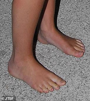 Jane said that Princess Eugenie has an elongated second toe, signaling leadership