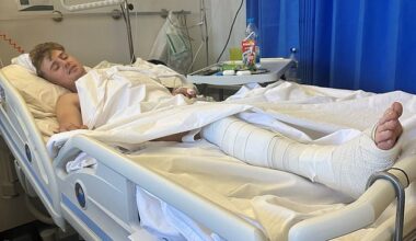 Doctors told Sam Hudson, 24, he is 'lucky to be alive' after falling from a second-floor balcony while on a 'lads holiday' to Ayia Napa