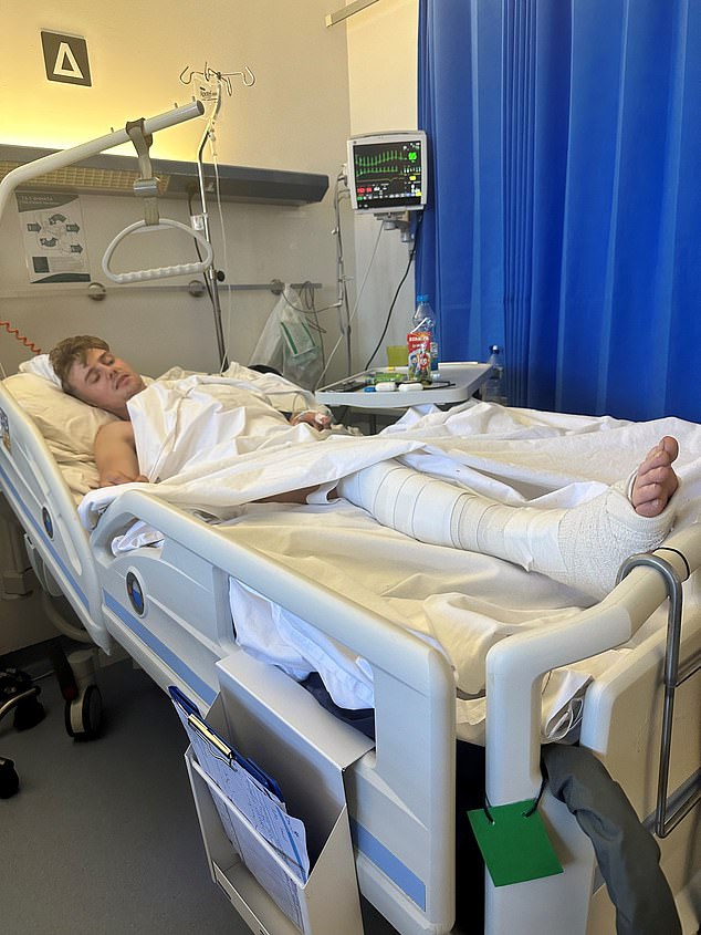 Doctors told Sam Hudson, 24, he is 'lucky to be alive' after falling from a second-floor balcony while on a 'lads holiday' to Ayia Napa