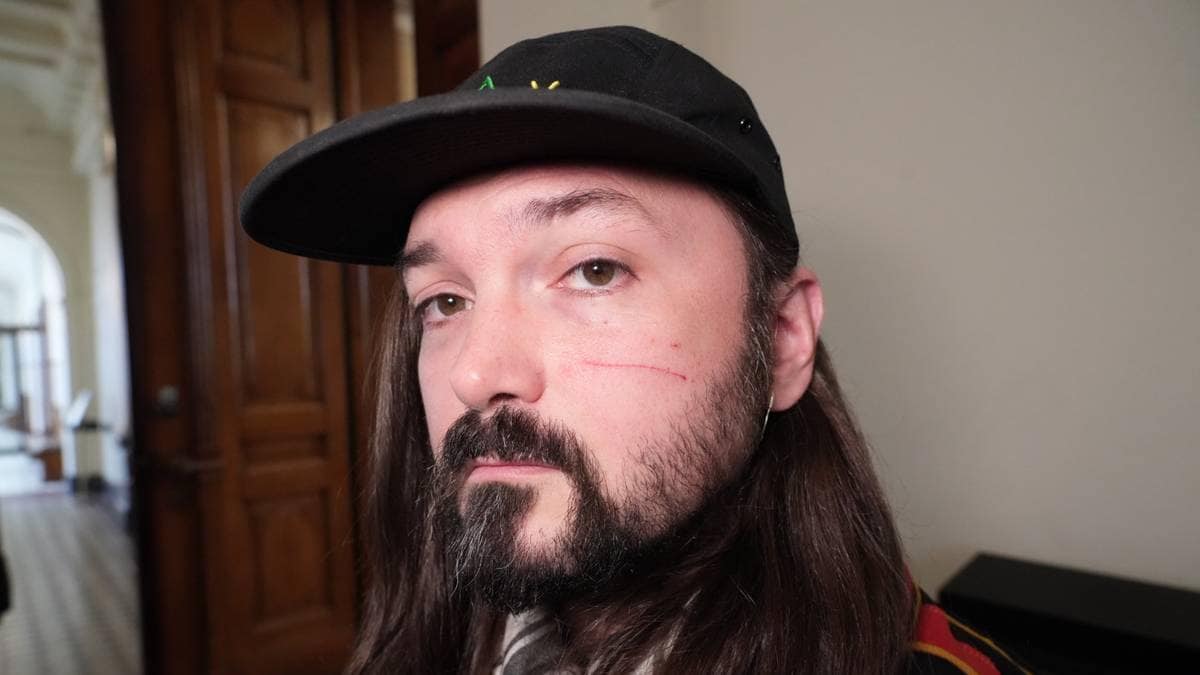 Mikkel har fått skade på venstre kinn da en mann slo til han da han stjal et pridehjerte laget av papp på den samiske barnehagen i oslo