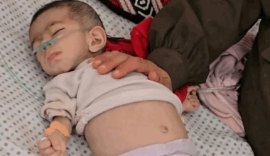 Confidential EU Document Accuses Israel of Weaponizing Starvation in Gaza