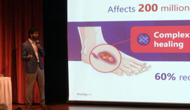 A man gives a presentation about diabetic foot ulcers, showing a slide with affected foot illustration and statistics on chronic wounds.