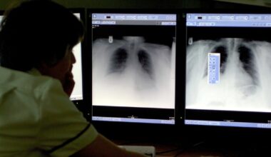 Northern Ireland’s cancer patients facing ‘a ticking time bomb’ over doctor shortages – The Irish News