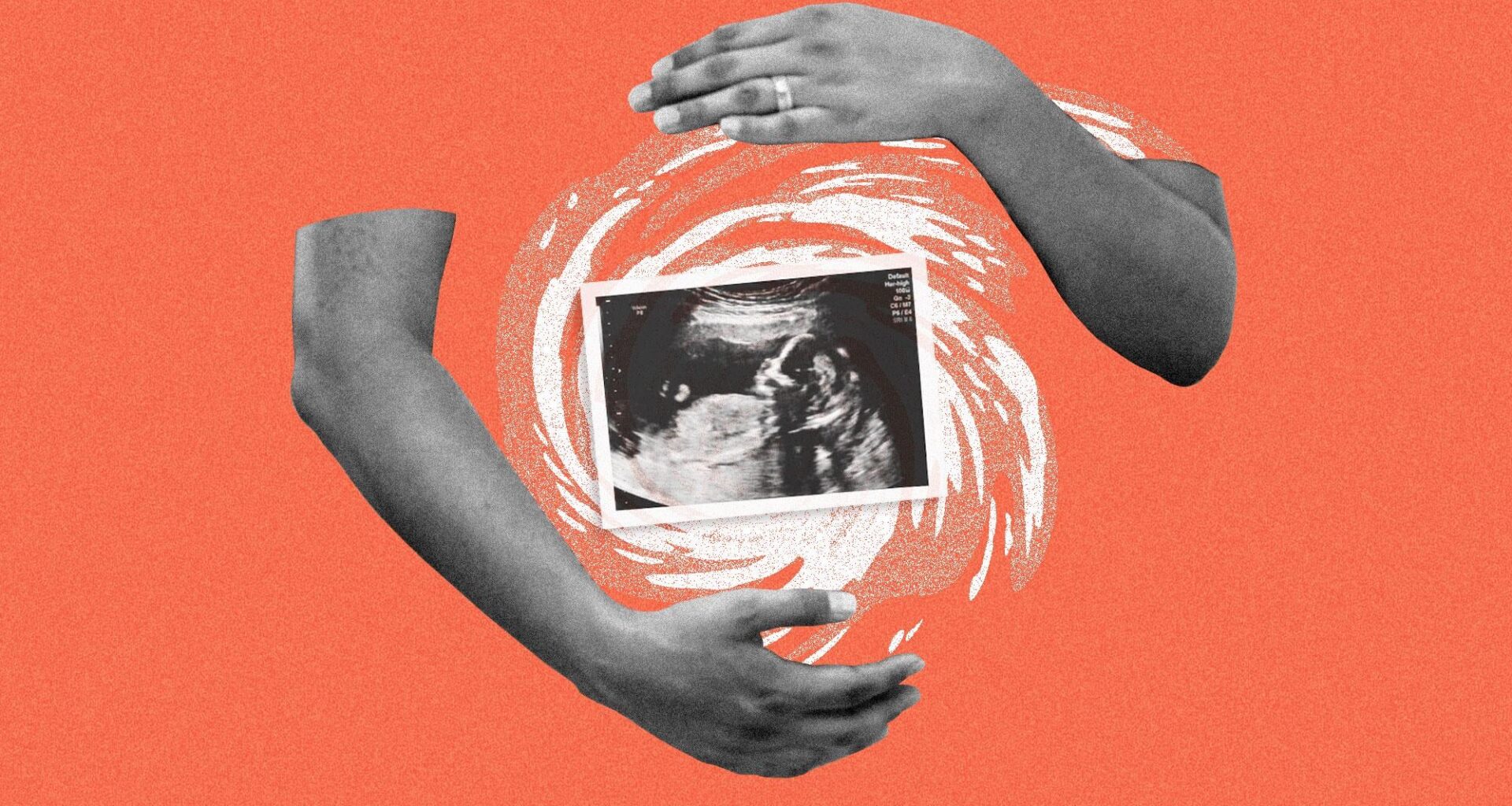 Climate disasters can alter kids’ brains — before they’re even born